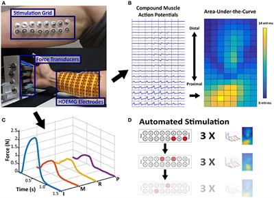 Variation of Finger Activation Patterns Post-stroke Through Non-invasive Nerve Stimulation